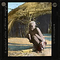 "A mutilated victim of Wemba savagery, Livingstonia", ca.1910 (imp-cswc-GB-237-CSWC47-LS4-1-020).jpg